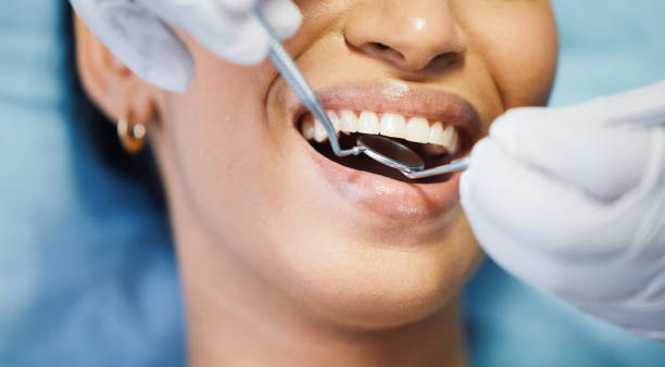 Best Emergency Wisdom Teeth Removal in Tipton, MO